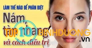 Cach Phan Biet Nam Tan Nhang Doi Moi Va Cach Dieu Tri Hieu Qua1609237340.jpg